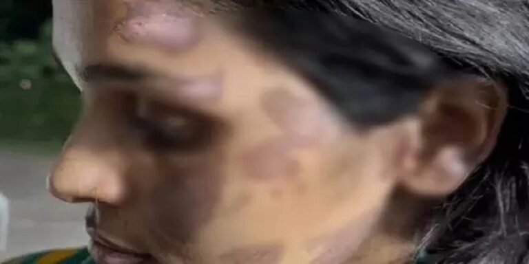 चेहरे-हाथ को जलाया, पत्नी को कई दिन तक बंधक बनाकर रखा था, पति गिरफ्तार